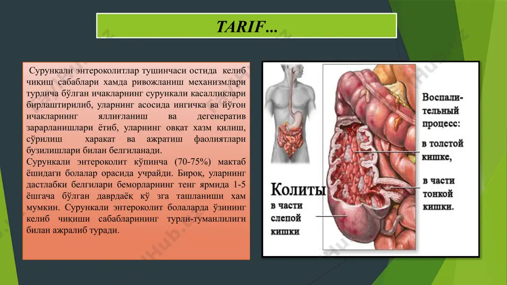 билан бир қаторда унинг парчаланиши оқибатида ҳосил бўлувчи махсулотларнинг токсикоаллергик таъсири ҳисобига содир булади. сурункали колит патогенезида узоқ кечувчи ичак дисбактериози ётади. ичак деворидаги сурункали яллиғланиш жараёни аутоантитело(“аутоагрессия”) ишлаб чиқиши ҳисобига ушлаб турилади. колит ривожланиши патологик ўчоқнинг локализациясига боғлиқ. кўр ичак сурункали ўнг томонлама чандиқли яллиғланган аднексит жараёнига ҳам қўшилиши мумкин. тифлитлар кўпроқ сурункали энтеритлар ва аппендицит билан бирга кечиши мумкин, у купроқ алиментар этиологияли булади. кўндаланг чамбар ичак ва асосан унинг дистал қисми яллиғланганда, ичак ичидаги сақланма чап талоқ бурчагидан чамбар ичакнинг пастга тушувчи қисмига ўтиши қийинлашади (талоқ бурчаги синдроми).сурункали проктит ва парасигмоидит келиб чиқишда асосан бактериал дизентерия, сурункали қабзият мухим ахамиятга эга. ичак деворини доимий таъсирланиши бунда асосий рол уйнайди. тасниф … болаларда сурункали энтероклитларнинг 1972 йилда таклиф қилинган классификациясидан фойдаланилади. бу классифиакцияга бинонан сурункали энтероколитлар келиб чиқишига кўра бирламчи ва иккиламичиларга; жараён активлигига кўра – актив ва ноактив фазаларига; касалликнинг оғир-енгиллигига қараб: енгил, ўртача оғирликда ва оғир …