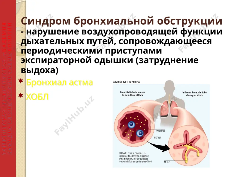 но и лишь при тяжелых обострениях целесообразна стационарная терапия. основные компоненты лечения включают: обучение больного. оценку и мониторирование тяжести течения с помощью пикфлоуметрии. контроль триггерных факторов, исключение (элиминацию) провоцирующих факторов. подбор фармакологических средств, включая базисные (противовоспалительные) и симптоматические (бронхолитические) препараты в зависимости от тяжести течения (см. таблицу). ташкентская медицинская академия кафедра клинический фармакологии ступеньчатая терания бронхиалной астмы ступеть 1 ступеть 2 ступеть 3 ступеть 4 ступеть 5 обучение пациентов элиминационные мероприятия β2-агонисты кортикого действия по потребности варианты поддерживающей теропии выберите один выберите один добавьте один или более добавьте один или более низкие дозы игкс низкие дозы игкс + β2-агонист дд средние или высокие дозы игкс + β2-агонист дд минимально возможная доза пераральнго гкс алп средние или высокие дозы игкс алп анти- igе низкие дозы игкс+алп теофиллин замедленного высвобождения низкие дозы игкс+тиафиллин замедл. высвоб ташкентская медицинская академия кафедра клинический фармакологии подбор фармакологических средств, включая базисные (противовоспалительные) и симптоматические (бронхолитические) препараты в …