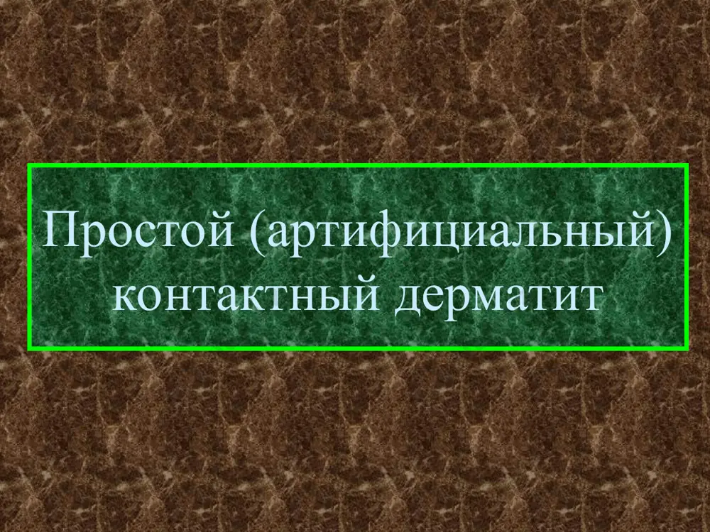 ергический дерматит буллезный контактный аллергический дерматит контактный аллергический дерматит лица контактный аллергический дерматит лица контактный аллергический дерматит лица контактный аллергический дерматит пальца контактный аллергический дерматит аллергический дерматит паховой области контактный аллергический дерматит контактный никелевый дерматит аллергический дерматит ладоней контактный аллергический дерматит кисти контактный аллергический дерматит лица фотодерматит фотодерматит фотодерматит фотодерматит токсикодермия распространенный аллергический дерматит распространенный аллергический дерматит токсикодермия токсикодермия токсикодермия эритродермия эритродермия эритродермия синдром лайела синдром лайела синдром лайела синдром лайела синдром лайела синдром лайела необходимо дифференцировать: - с синдромом стивенса-джонсона - с буллезным врожденным эпидермолизом буллезный эпидермолиз буллезный эпидермолиз буллезный эпидермолиз буллезный эпидермолиз буллезный эпидермолиз кистей буллезный эпидермолиз симптом никольского - с пузырчаткой атопический дерматит атопический дерматит в области нижних конечностей атопический дерматит в области нижних конечностей атопический дерматит в области молочных желез периоральный дерматит папулезный акродерматит фолликулярные папулы при атопическом дерматите атопический дерматит в области вульвы крапивница крапивница отек квинке крапивница отек квинке холодовая крапивница пигментная крапивница пигментная …