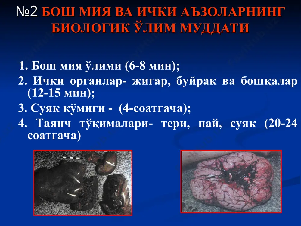 ади, бу соатлаб,суткалаб,хафталаб,ойлаб давом этиши мумкин; 4. клиник ўлим 3 – 5 - 6 – 8 минутни ташкил этади. преагонияда - беморда хушнинг карахтлашиши, рефлексларнинг сўниши, бироқ нафас, юрак фаолияти сақланган бўлади. терминал паўза - юқоридаги белгиларга юрак ва нафас тухташи қушилади, лекин бу тез ўтиб кетади. 1-3 мин. давом этади; агония-.унинг пассив(рефлекслар суст, қон босими тушади, тахикардия, жағи осилган, оғзидан сўлак оқиши, юзи оқаради, кўз олмалари чўккандек, бурун қирралашгандек кўринади) ҳамда актив(бунда бемор фаоллашади,атрофдаги кишилар билан мулоқотга киришади) турлари фарқланади. клиник ўлим- бу юрак нафас фаолиятининг батамом тухташи.5-6 мин. давом этиши мумкин. №6 «мия» ўлими диагностикаси. беморнинг батамом турғун ва пассив ҳолати. барча мушакларнинг атонияси. кон босимининг кескин пасайиши(80/40мм.с.у.). рефлексларнинг йўқолиши. қорачиқнинг турғун кенгайиши. хушнинг турғун йўқлиги. мия потенциалининг йўқолиши (стационар шароитида). белоглазова симптомининг мусбат булиши ёки (мушук қорачиғи симптоми) -ўлимдан 10-15мин. сунг кўзатилади,одам қорачиғи мушук қорачигиға ухшаб қолади,яъни одам кўз олмасига бармоқ билан енгил босилганда кўз қорачиғи шаклини …
