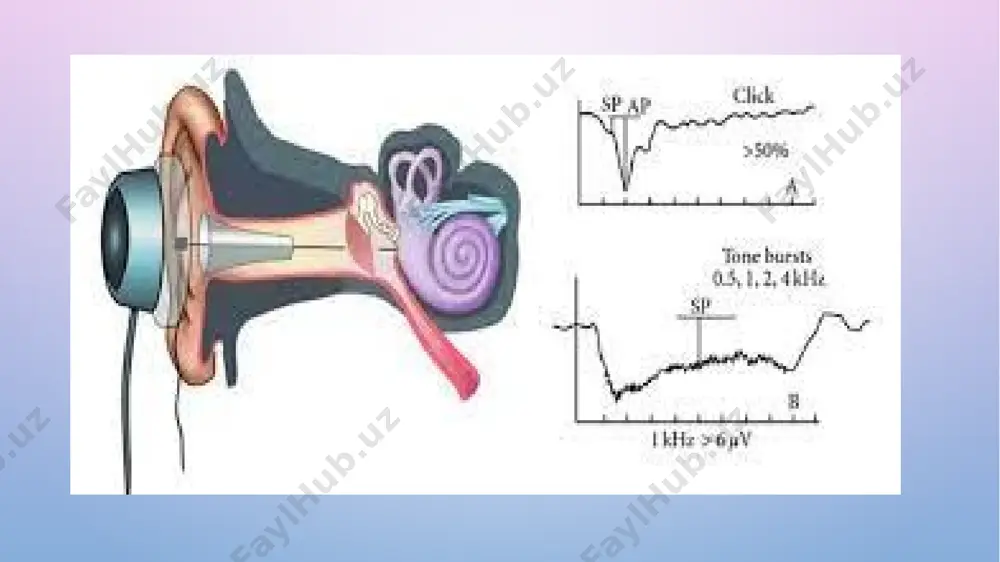 koxler implant orqali qayd etilgan cm artefaktni o'z ichiga olmaydi. klinik jihatdan u koxlear implant elektrodini kiritish paytida darhol o'zgarishlarni ko'rsatish uchun ishlatilishi mumkin. sp - bu o'zgaruvchan tok stimuliga javoban paydo bo'ladigan doimiy oqim potentsiali. shunday qilib, potentsial chiziqli bo'lmagan javob bo'lib, generator bir qutbda boshqasiga emas, balki ko'proq elektr potentsialini ishlab chiqarishga olib keladi. ko'p potentsial manbalar mavjud, ammo asosiy manba bazilyar membrananing yuqori stimulyator intensivligida chiziqli bo'lmagan tebranishidir va bu cmning teng bo'lmagan chiqishiga olib keladi. eshitish testi elektrokoxleografiya dastlab yosh bolalar uchun ob'ektiv eshitish testi sifatida ishlatilgan (ruben va boshqalar, 1960), lekin asosan kamroq invaziv testlar bilan almashtirildi. eshitish sub'ektiv hodisadir va ecochg faqat koxlear cap chegarasini tekshiradi. shunga qaramay, koxler disfunktsiyaning odatiy joyi sifatida, odatda to'g'ridan-to'g'ri eshitish chegarasi bilan bog’liq. cap chegarasi faqat transtimpanik elektrod yordamida olinishi mumkin va yosh bolalar umumiy behushlik talab qiladi. chaqaloqlarni tabiiy uyqu yoki sedasyon paytida eshitish miya sopi javoblari …