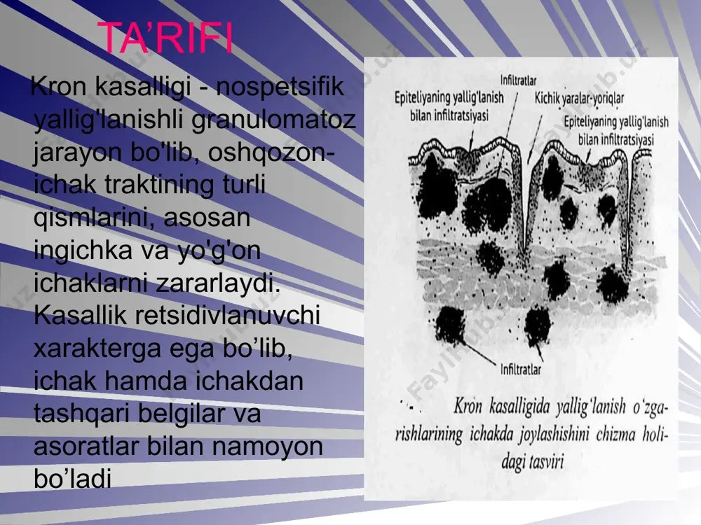oqmalari, infiltratlar va absesslar, ichakdan qon ketishi sepsis perforatsiya (natijada peritonit) malignizatsiya diagnostikasi umumiy qon tahlili- kamqonlik, leykotsitoz, echt oshishi umumiy siydik tahlili-proteinuriya, gematuriya qon biokimyoviy tahlili-gipoproteiemiya, foliy kislotasi va vitamin b12 kamayishi umumiy najas tahlili-steatoreya, najasda qon, leykotsitlar va epiteliy hujayralari topiladi zond yordamida contrast modda yuborib ingichlka ichakni tekshirish irrigoskopiya- contrast modda yuborib yo’g’on ichakni tekshirish kolonoskopiya biopsiya davolash dieta 5-aminosalitsil kislotasi hosilalari- sulfasalazin, mesalazin (kuniga 3-4 g dan, 8-12 hafta) glyukokortikoidlar- prednizolon (kuniga 40-60 mg dan, 2-3 hafta) antibiotiklar- siprofloksatsin, metronidazol (10-14 kun) immunodepressantlar- azatioprin, metotreksat profilaktikasi sog’lom turmush tarzi ratsional ovqatlanish zararli odatlardan saqlanish lekin kasallikning yo’naltirilgan birlamchi profilaktikasi mavjud emas! e’tiboringiz uchun tashakkur image4.jpeg image5.jpeg image1.png image2.png image3.png image6.png /docprops/thumbnail.jpeg