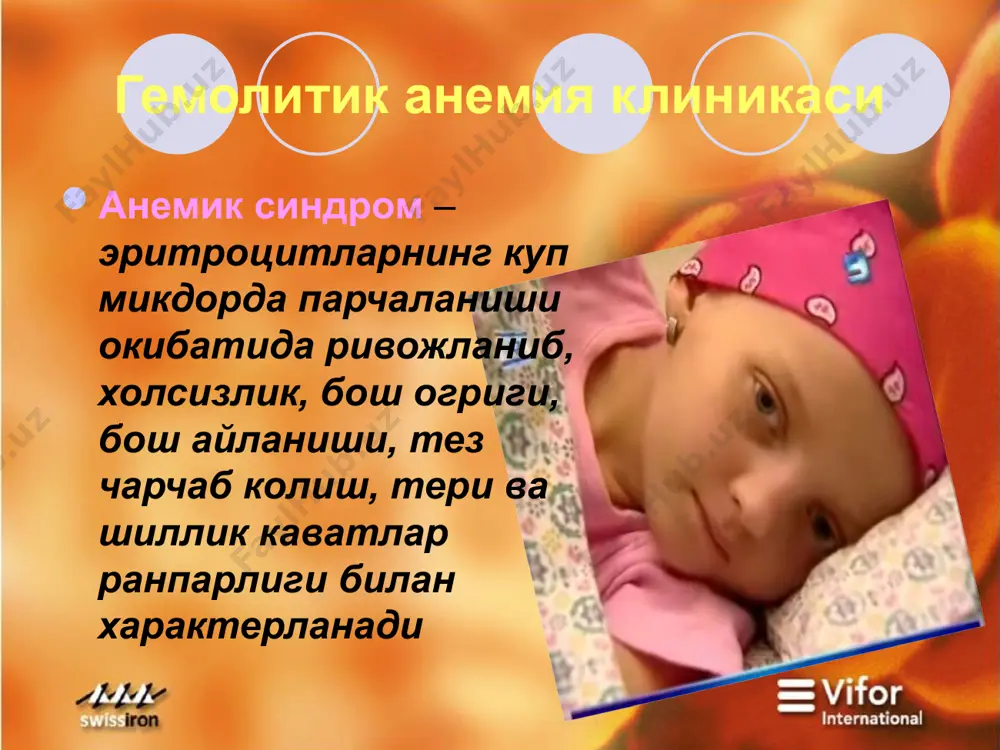 гемолитик анемия - Page 4