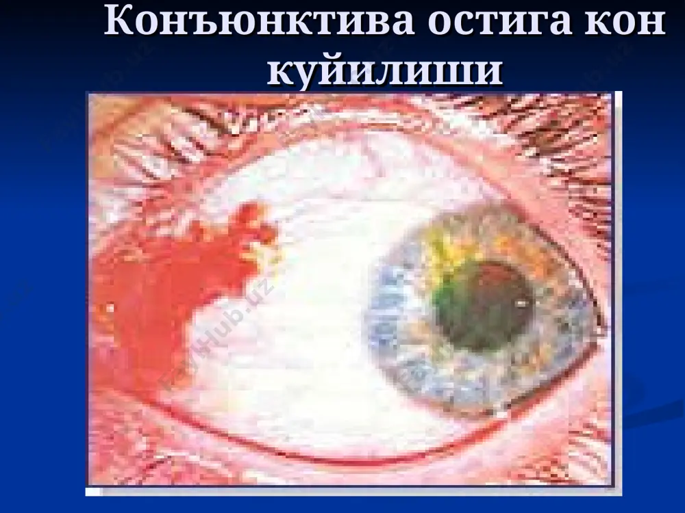 курув аъзоси травмалари - Page 5