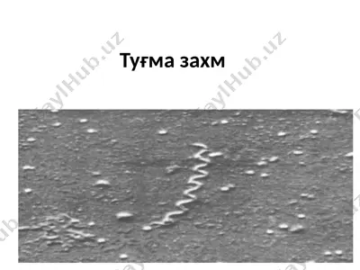 tug'mazaxm — PPTX