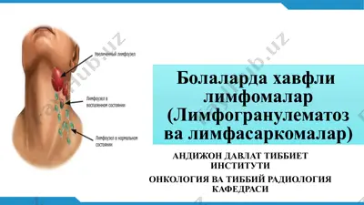 limfogranulematozvalimfasarkomalar — PPTX