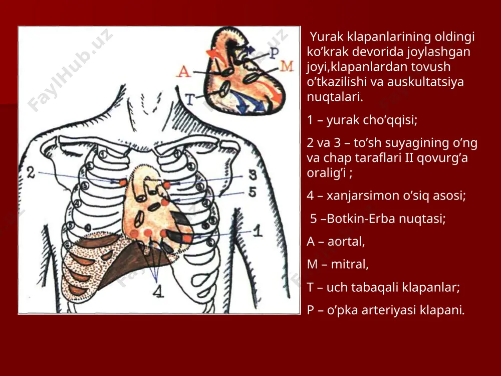 miokardining bo’shashish tezligi; tebranish xarakatlarida ishtirok etuvchi strukturalar zichligi, birinchi navbatda yarimoysimon klapanlar,shuningdek magistral tomirlar devori zichligiga bevosita protodiastolik davrdan oldin yarimoysimon klapanlar tabaqalarining joylashishiga. yurak ii tonining susayishi. ii tonning asosiy sabablari hisoblanadi: o’pka arteriyasi va aorta yarimoysimon klapanlarining germetik bekilishining buzilishi; yarimoysimon klapanlar yopilish tezligining susayishi: а)qorinchalar bo’shashish tezligining kamayishi bilan bog’liq yurak yetishmovchiligi. б) arterial bosimning kamayishi; 3) yarimoysimon klapanlar tabaqalarining xarakati kamayishi va bitishishi,masalan,aorta darvozasi klapanli stenozida. yurak ii tonining kuchayishi(aksenti) aortada ii ton kuchayish(aksent ) sabablari bo’lishi mumkin: turli kelib chiqishli arterial bosimning oshishi (aorta klapani tabaqalarining qarsillash tezligi bilan bog’liq; aorta devori va aortal klapan tabaqalarining zichlashishi (аteroskleroz, sifilitik artrit va boshqalar. o’pka arteriyasida ii tonning kuchayishi(aksent) o’pka arteriyasida yuqori bosimdan darak beruvchi asosiy belgi xisoblanadi(mitral stenozda, o’pka yurakda, chap qorinchali yurak yetishmovchiligi va boshqa kasalliklarda) yurak tonlarining bo’linishi i ton bo’linishining asosiy sababi mitral va trikuspidal klapanlarning nosinxron yopilishi va tebranishiga bog’liq. esda …