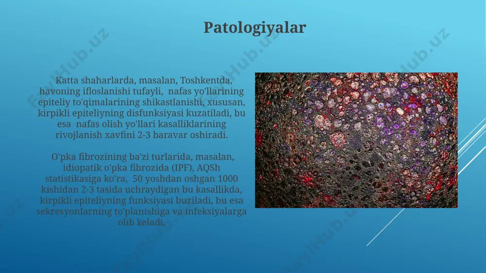 adi, bu esa 1000 kishiga 15 dan ortiq holatlarni tashkil qiladi. bir qatlamli, koʻp qatorli, silindrsimon kirpikli epiteliyning buzilishi nafas yoʻllarining 80% gacha kasalliklariga, jumladan, bronxit va pnevmoniyaga olib kelishi mumkin, bu esa jahon sogʻliqni saqlash tashkiloti maʼlumotlariga koʻra, yiliga 3 million oʻlimga sabab boʻladi. e'tiboringiz uchun rahmat @taqdimot_robot image1.jpg image2.jpg image3.jpg image4.jpg image5.jpg image6.jpg image7.jpg image8.jpg image9.jpg image10.jpg image11.jpg image12.jpg image13.jpg image14.jpg image15.jpg image16.jpg image17.jpg