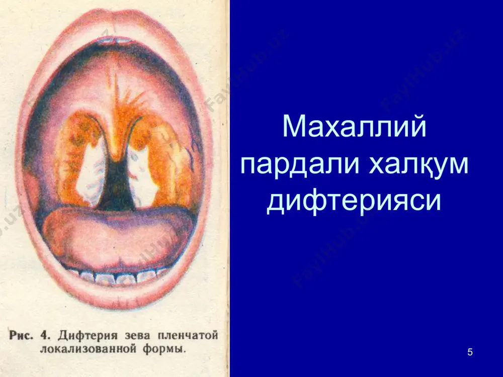 difteriyakasalliginingepidemiologiyasi, profilaktikasi va epidemiologik nazorati - Page 5