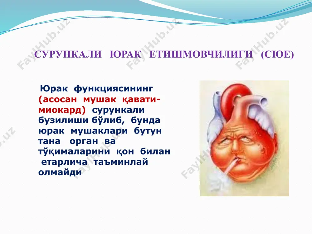 инал босқичи. сюе таснифи (функционал синфлари): nyha (нью-йорк кардиологлари ассоциацияси) бўйича синф симптомларнинг намоён бўлиши i синф жисмоний фаоллик чекланмаган. кундалик жисмоний зўриқишларда ҳолсизланиш, нафас сиқиши, юракни тез уриши кузатилмайди. ii синф жисмоний фаоллик бирмунча чекланган, аммо тинч ҳолатда шикоят йўқ. кундалик зўриқиш (масалан, оғир нарсаларни кўтариш) ҳолсизланишга, нафас сиқишига, юракни тез уришига сабаб бўлиши мумкин. iii синф жисмоний фаоллик сезиларли чекланган. озгина жисмоний зўриқишда ҳам шикоятлар бор. тинч ҳолатда шикоят йўқ. iv синф жисмоний фаоллик кескин чегараланган. тинч ҳолатда ҳам шикоятлар бор ва озгина зўриқишларда кучаяди. ташхис? асосий: юик. зўриқиш стенокардияси фс iii. иккс (2015й) ёндош: гипертония касаллиги iii босқич. аг 2- даража. хавф iv (жуда юқори) асорати: cюе ii б. iii фс (nyha буйича). ўткир юрак етишмовчилиги классификацияси (t.killip бўйича, 1967й) юрак етишмовчилиги (юе) босқичи клиник белгилари стационар ўлим (ўми да) i босқич юе белгилари йўқ 6% ii босқич юе белгилари (ўпка пастки қисмида нам хириллашлар, ўпкада веноз …