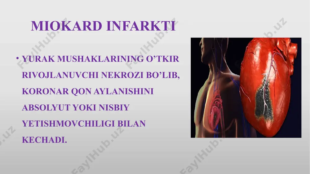 iyatsiz stenoz e, f, g, h – gemodinamik jihatdan ahamiyatli stenoz patofiziologiyasi miyokard infarktida miokardning qisqaruvchanlik funktsiyasi yurakning shikastlangan sohasi maydoniga bog'liq, shuning uchun bu funktsiyani buzilishi gipokinesiya, akineziya yoki diskineziya (sistola paytida yurak qismining parodoksal bo’rtib chiqishi) bilan namoyon bo'ladi. maydon qancha ko'p zararlangan bo'lsa, chq ning nasos funktsiyasi shunchalik past bo'ladi: agar chq qisqaruvchanlik 10% dan ko'proq kamaysa, u holda zh (zarb hajmi) kamayadi. agar u 15% dan oshsa, u holda oxirgi diastolik bosim va chq hajmi oshadi. agar u 25% dan oshsa, o'pka shishi paydo bo'ladi va agar u 40% dan oshsa, kardiogen shok vujudga keladi. zararlanish maydonini kamaytirish bemorning patofiziologik va klinik holatini yaxshilaydi. 10 miokard infarkti tasnifi i. yurak mushagi zararlanish o’chog’ning kengligi va chuqurligi bo'yicha : q tishli q tishsiz subendokardial va intramural iii. im ni lokalizatsiyasi bo‘yicha : oldingi septal (oldto’siq); oldingi apikal; anterolateral (oldingi yon); anterobazal (yuqori old); keng tarqalgan old (septal, …