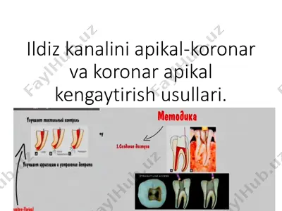 ildiz kanalini apikal-koronar va koronar apikal kengaytirish usullari — PDF