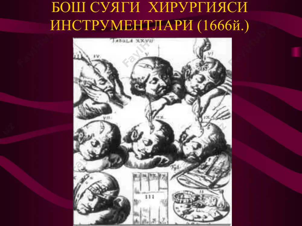 neyroxirurgiya rivojlanish tarixiprof.kariev m.x. - Page 5