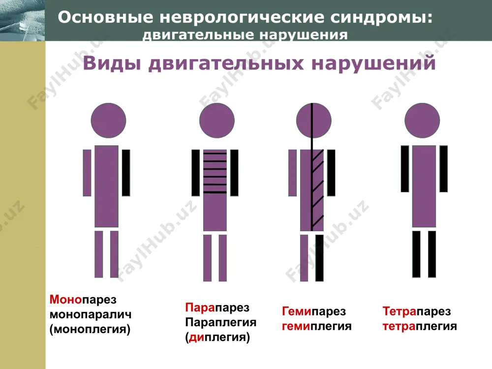 и сердца и других внутренних органов; эндокринные нарушения. нарушение интеллекта. особенность специфическая внешность больного. рекомендации комплексная лечебно-коррекционная работа, направленная на социальную адаптацию детей. www.themegallery.com company logo врожденная патология нервной системы гидроцефалия – микроцефалия – прогрессирующее увеличение размеров головы вследствие избыточного скопления спинномозговой жидкости в полости черепа. причины врожденные пороки развития ликворной системы. клинические признаки прогрессирующее увеличение размеров головы. вследствие давления цереброспинальной жидкости на мозг развиваются нарушения двигательной сферы, снижение зрения и слуха. страдают вегетативные функции. снижается интеллект. возможны случаи сохранного интеллекта. гипертензии в период декомпенсации вызывают сильные головные боли, тошноту, головокружение, нарушение координации движения. уменьшение размеров черепа и мозга. может встречаться как самостоятельный синдром и как симптом при хромосомных болезнях. причины воздействие на развивающийся мозг неблагоприятных факторов. клинические признаки значительное уменьшение массы мозга, недоразвитие коры головного мозга (особенно лобных долей). основное проявление болезни – интеллектуальный дефект в значительной степени (имбецильность, идиотия). наблюдаются также неврологические нарушения: спастические параличи и парезы, косоглазие, …