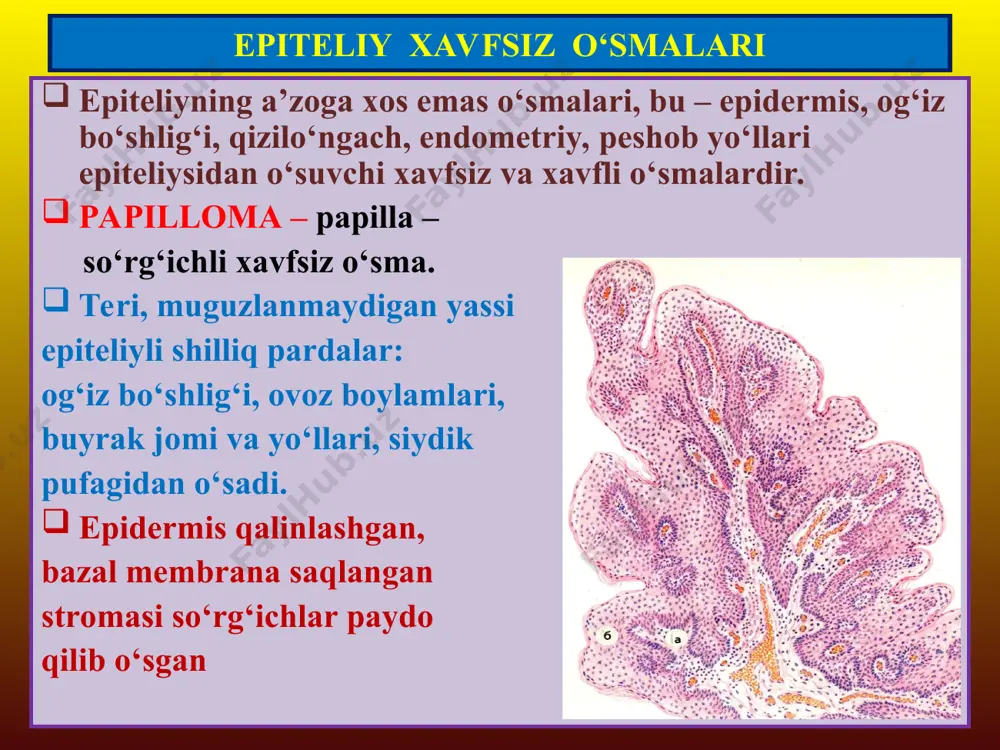 t to‘qimalari, seroz pardalar, qon tizimi to‘qima va hujayralarini paydo qiladi. mezenximaning o‘zidan ham tug‘ma, ya’ni embrional aralash tarkibli o‘smalar o‘sishi mumkin. xavfsiz o‘smalari – to‘qima yoki hujayraning lotincha nomiga +oma qo‘shib nomlanadi: osteoma, xondroma, lipoma, leyomioma, rabdomioma va x. xavfli o‘smalari - to‘qima yoki hujayraning lotincha nomiga +sarkoma qo‘shib nomlanadi: ostesarkoma, xondrosarkoma, liposakroma, leyomiosakroma, rabdomiosarkoma va x. mezenximal to‘qima o‘smalari mezenximal to‘qima o‘smalari to‘qima xavfsiz xavfli 1) biriktiruvchi to‘qima (fibroz to‘qima) fibroma: qattiq, yumshoq, desmoid fibrosarkoma: differensiallangan, differensiallanmagan 2) yog‘ to‘qima (qo‘ng‘ir yog‘) lipoma (gibernoma) liposarkoma 3) silliq mushak leyomioma leyomiosarkoma 4) ko‘ndalang targ‘il mushak rabdomioma rabdomiosarkoma 5) qon tomirlar gemangioma: kapillyar, venoz, kavernoz, glomusangioma angiosarkoma: sarkoma gemangioeyedotelial va gemangioperisitar 6) limfa tomirlar limfangioma limfangiosarkoma 7) sinovial parda sinovioma sinovial sarkoma 8) mezoteliy mezotelioma mezoteliy sarkoma 9) suyak to‘qima osteoma osteosarkoma 10) tog‘ay to‘qima xondroma xondrosarkoma fibroma (teri dermasida) fibrosarkoma mezenximal to‘qima o‘smalari xondroma xondrosarkoma mezenximal to‘qima o‘smalari jigar …