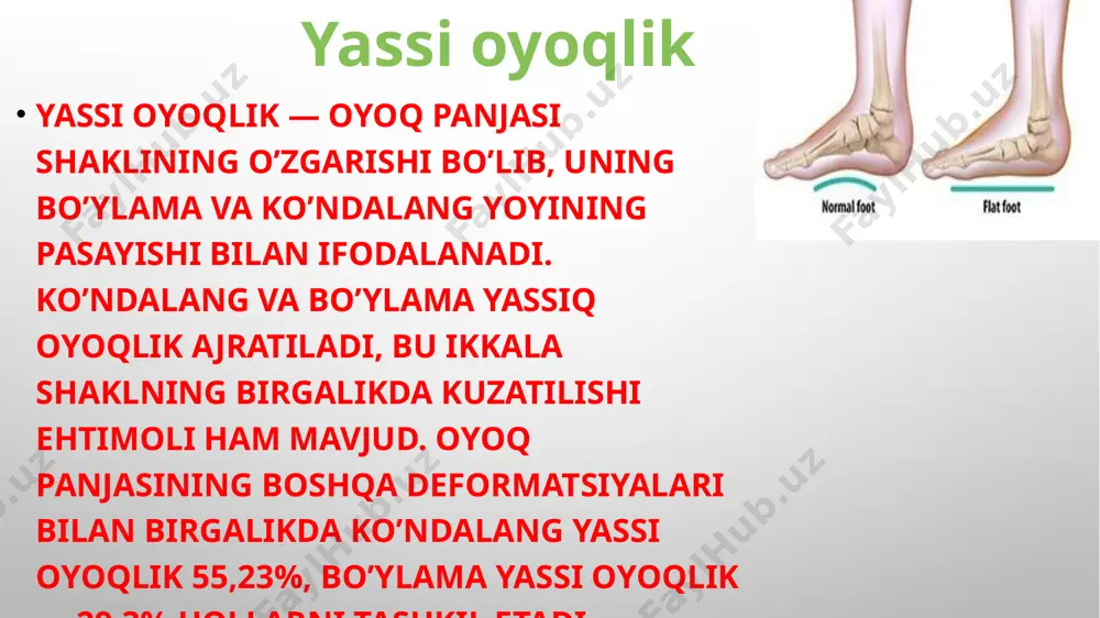 q o’t, toshlar, qum, tuproq bo’lishi mumkin (agar ularda yalang oyoq yurilsa). oyoq panjasi uchun parket, laminat va boshqa qattiq qoplamalar, shuningdek qattiq tagcharmli poyabzal agressiv hisoblanadi, bunda oyoq mushaklari faoliyat ko’rsatmaydi. har bir inson ishlamaydigan mushaklar atrofiyaga uchrashini biladi. kosmos kashshoflari o’z ona zaminlariga qaytib kelishganda yura olishmagan ekan (tortisish kuchi yo’qligining uzoq vaqt ta’sir qilishi tufayli). shundan so’ng kosmosda mushaklar va boylamlarni trenajorlar yordamida zo’riqtirish kerakligi qabul qilingan. yassi oyoqlik sabablari shu tariqa, yuk tushmagan oyoq panjasi yoylari ham dangasa bo’ladi va zaiflashadi: kishi umrini oxirigacha yassi oyoqlikni orttirib oladi. biroq, ikki yil avval yosh yigit bir shifokor oldiga borib, otasi kabi zobit bo’lishni istashini, lekin oyoqlari yassi bo’lganligi tufayli tibbiy komissiya orqali o’tolmaganini bildirdi. sakkiz oylik oyoq mushaklari va boylamlari ustida mashaqqatli mehnat qilib, oliy harbiy muassasa kursantiga aylandi. adabiyotga ko’ra, 65% va undan ko’p bolalar maktab yoshiga qadar yassi oyoq bo’lib qolishadi. agar aholining aksariyati shifokorga …