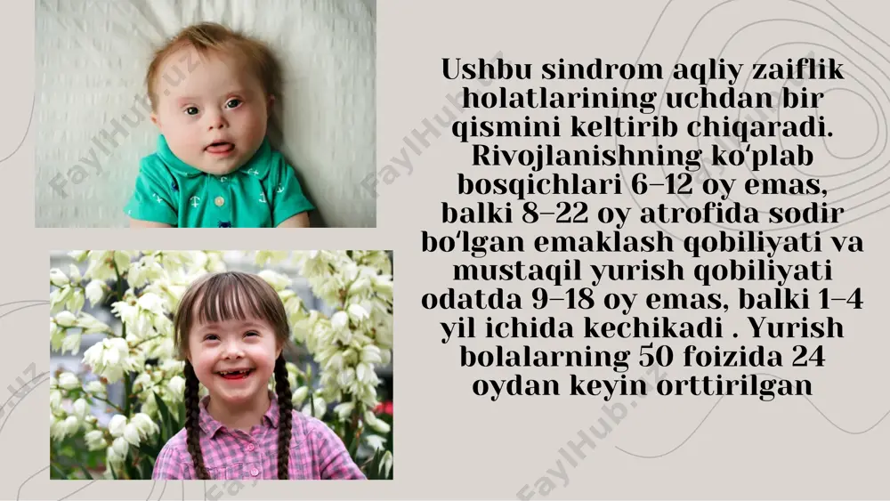 daun sindromi - Page 4