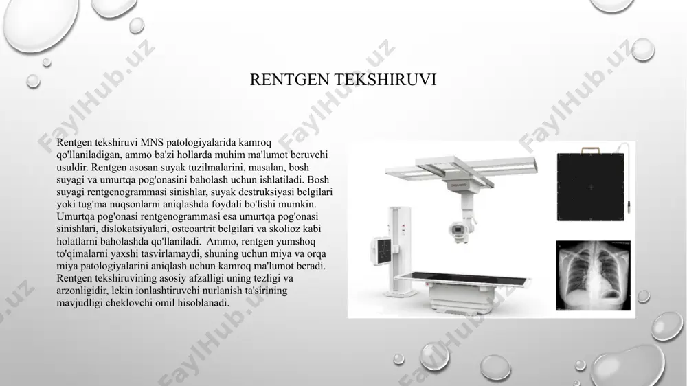 miya qon tomirlariga yo'naltirishni o'z ichiga oladi. kontrast modda yuboriladi va rentgen tasvirlari qon tomirlarini vizualizatsiya qilish uchun olinadi. an'anaviy angiografiya qimmatbaho invaziv usul bo'lib, qon tomirlari patologiyalarini, masalan, anevrizmalar, arteriovenoznie malformatsiyalar va vazospazmni aniqlashda "oltin standart" hisoblanadi. zamonaviy angiografiya usullari kt-angiografiya va mrt-angiografiyani o'z ichiga oladi. kt-angiografiya va mrt-angiografiya kamroq invaziv usullar bo'lib, vena ichiga kontrast modda yuborish orqali amalga oshiriladi. bu usullar qon tomirlarining tasvirini olish va qon tomirlari patologiyalarini tashxislash uchun etarli ma'lumot beradi. xulosa mns patologiyalarini diagnostika qilishda nur tekshiruv usullari muhim rol o'ynaydi. har bir usulning o'ziga xos afzalliklari va cheklovlari mavjud bo'lib, ularni to'g'ri tanlash bemorga mos diagnostika yondashuvini ta'minlashda hal qiluvchi ahamiyatga ega. rentgen tekshiruvi suyak tuzilmalarini baholash uchun foydali, kt tez va suyaklar, qon ketishlar va yirik o'smalarni aniqlashda samarali, mrt yumshoq to'qimalarni batafsil tasvirlash va turli xil patologiyalarni aniqlashda eng sezgir usuldir. utt yangi tug'ilgan chaqaloqlarda bosh miyani tekshirishda qo'llaniladi, angiografiya …