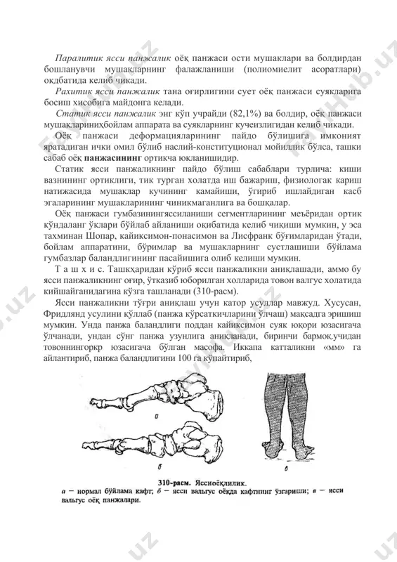 biga maydonga keladi. statik yassi panjalik eng ko'p uchraydi (82,1%) va boldir, oyoq panjasi mushaklarinihboylam apparata va suyaklarning kucheizligidan kelib chikadi. oyoq panjasi deformatsiyalarining paydo bo'lishiga imkoniyat yaratadigan ichki omil bo'lib nasliy-konstitutsional moyillik bo'lsa, tashki sabab oyoq panjasining ortikcha yuklanishidir. statik yassi panjalikning paydo bo'lish sabablari turlicha: kishi vaznining ortikligi, tik turgan xolatda ish bajarish, fiziologak karish natijasida mushaklar kuchining kamayishi, o'girib ishlaydigan kasb egalarining mushaklarining chinikmaganliga va boshqalar. oyoq panjasi gumbaziningyassilanishi segmentlarining me'yoridan ortik ko'ndalang o'klari bo'ylab aylanishi oqibatida kelib chiqishi mumkin, u esa taxminan shopar, kayiksimon-ponasimon va lisfrank bo'g'imlaridan o'tadi, boylam apparatini, bo'rimlar va mushaklarning sustlashishi bo'ylama gumbazlar balandligining pasayishiga olib kelishi mumkin. t a sh x i s. tashkharidan ko'rib yassi panjalikni aniqlashadi, ammo bu yassi panjalikning og'ir, o'tkazib yuborilgan xollarida tovon valgus xolatida kiyshayganidagina ko'zga tashlanadi (310-rasm). yassi panjalikni to'g'ri aniqlash uchun kator usullar mavjud. xususan, fridlyand usulini qo'llab (panja ko'rsatkichlarini o'lchash) maqsadga erishish mumkin. unda …