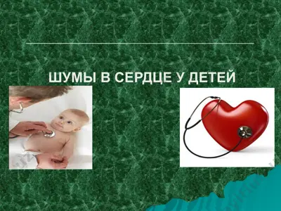 шумы в сердце у детей — PPTX