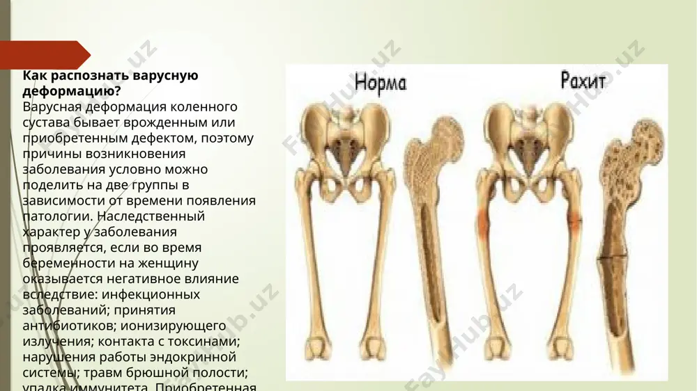 тренировок для исправления деформации нижних конечностей — гарантия положительного результата. лечебную физкультуру условно можно поделить на комплексы упражнений в зависимости от положения тела и дополнительного снаряжения: положение сидя — количество повторений от 20 раз: стопы по очереди сгибаются, а затем разгибаются; правая ступня вращается по часовой стрелке, после чего левая — против; таз размещается между пятками — поза фиксируется до счета 20. положение стоя — количество повторений от 20 раз: ступня плотно прижимается к полу, с использованием опоры человек приседает; спина находится вплотную к стене, тело опускается на корточки; тело удерживается только пятками; под ноги ложиться возвышение — книга, пятки опускаются до пола. профилактическая ходьба — продолжительность 1—2 минуты: на полу протяжностью 1,5 метра выкладывается «елочка», нога ступает под углом 20—30 градусов; шагание на пяточках; ходьба на корточках, руки упираются в талию. применение дополнительного инвентаря —массажного мячика, количество повторений 10—15 раз: катается на полу от кончиков пальцев к пятке и …