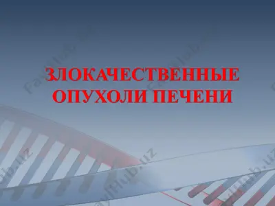 злокачественные опухоли печени — PPTX