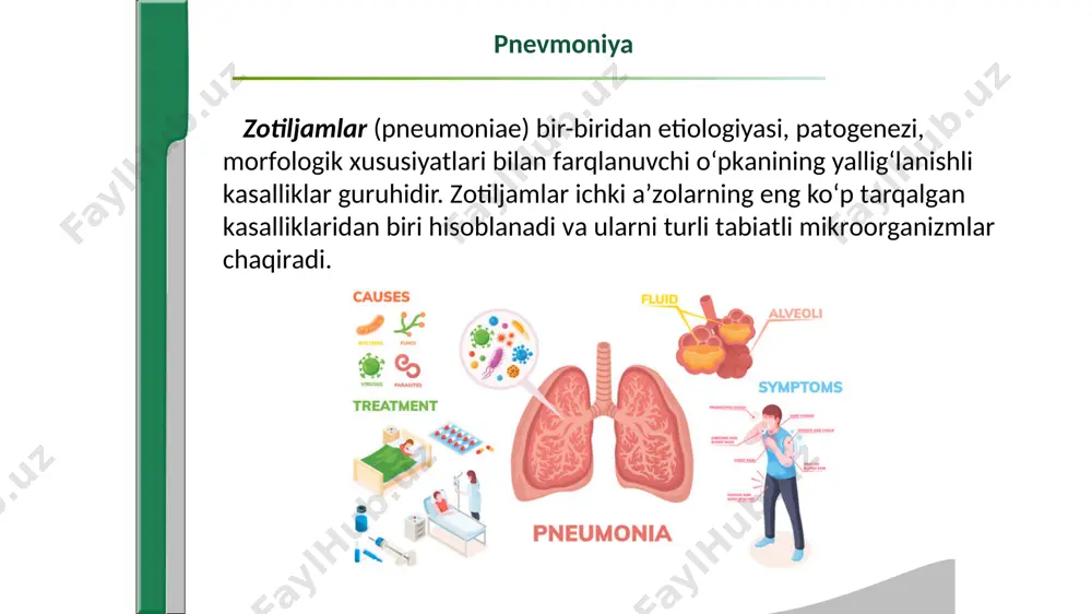 i so‘ndirib o‘pkadagi qon aylanishini buzilishiga va oqibatda bronxiolalar va alveolalar zararlanishiga olib boradi patogenezi xalqaro klassifikatsiyaga muvofiq (yevropa respirator jamiyati, 1995 y.) zotiljamlarni quyidagi turlari farqlanadi: 1) shifoxonadan tashqari (birlamchi); 2) shifoxona ichi (nozokomial) - boshqa kasalliklar sababli yotqizilgandan 48 – 72 soat o‘tgach; 3) immunitetida og‘ir yetishmovchilik bo‘lgan shaxslarda; 4) atipik. tasnifi etiologik omildan kelib chiqib bakterial (pnevmokokkli, stafilokokkli va boshqalar), virusli, mikoplazmali va boshqa zotiljamlar ajratiladi. patogenezi bo‘yicha mustaqil kasallik sifatida paydo bo‘luvchi va kechuvchi birlamchi zotiljamlar va boshqa kasalliklar kechishini og‘irlashtiruvchi ikkilamchi zotiljamlar farqalanadi. ikkilamchi zotiljamlarga qonni kichik qon aylanish doirasida turib qolishi natijasida paydo bo‘luvchi gipostatik zotiljamlar (bemorlar uzoq vaqt yotoq tartibiga rioya qilishga majbur bo‘lganda), nafas olish yo‘llariga ovqat, qayt qilish qoldiqlari va boshqa moddalarni tushishi (hushsiz yotgan odamlarda) aspiratsiyali zotiljamlar, operatsiyadan keyingi, travmatik, infarktli zotiljamlar (mayda o‘pka arteriyasi emboliyasi tufayli) va boshqalar. nihoyat klinik-morfologik xususiyatlari bo‘yicha parenximatoz (krupoz va o‘choqli) va interstisial zotiljamlar …