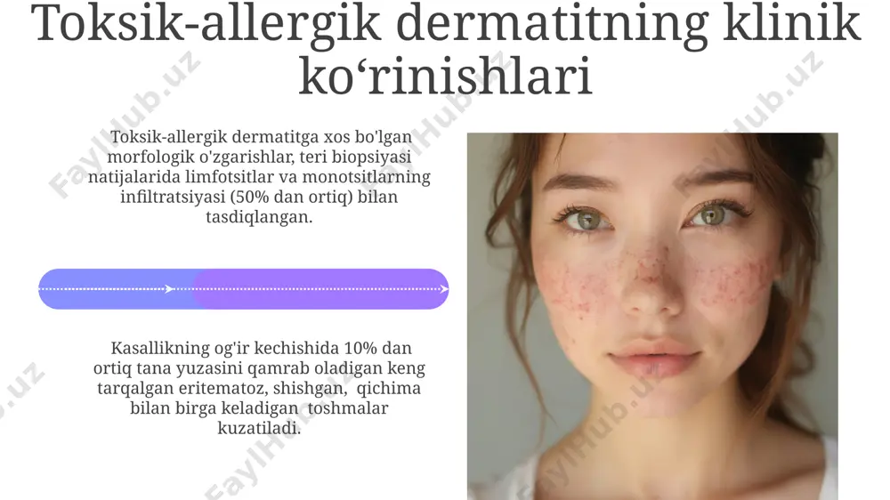 oddiy va allergic kontakt dermatit. toksik-allergik dermatit. ekzema - Page 4