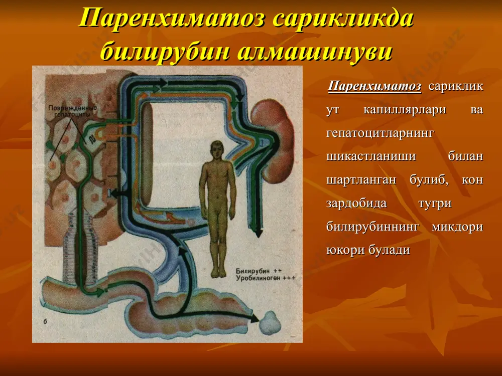 езда утк нинг борлиги ут санчиги хуружлари иситма, калтираш анамнезидаги ут йулларидаги операциялар тургун тери кичимаси тана вазнининг камайиши ёшнинг улуглиги асбоб-ускунали текширув усуллари 1. ноинвазив усуллар: утт компьютер томография 2. инвазив усуллар: эрхпг тери-жигар оркали хг утт сезгирлик - 70-90%, махсуслик - 80-85%. утт компьютер томография сезгирлик - 70-90%, махсуслик - 80-85%. эндоскопик ретроград панкреатохолангиография сезгирлик - 90-98%, махсуслик – 90-100%. тери ва жигар оркали холангиография сезгирлик - 100% гача, махсуслик - 90%. тери ва жигар оркали холангиография механик сарикликдаги ташхис алгоритми сариклик утт ишкорий фосфатаза ёки трансаминазалар микдорининг ошиши билиар обструкция мумкинлиги рпхг, тжохг, кт даво чора-тадбирлари (анъанавий ёки кам инвазияли жаррохлик) анамнез, физикал текширувлар, оддий лаборатор текширувлар механик сарикликнинг клиникаси сарикликдаги асосий клиник белгилар огрик, унг ковурга остидаги огрик; кайт килиш; иштаханинг пасайиши; озиш; ич келишининг бузилиши,нажаснинг окариши; юкори тана харорати, иситма; тери копламалари ва шох парда, шиллик каватларнинг саргайиши; тери кичимаси ва теридаги кашиш излари; пешобнинг …