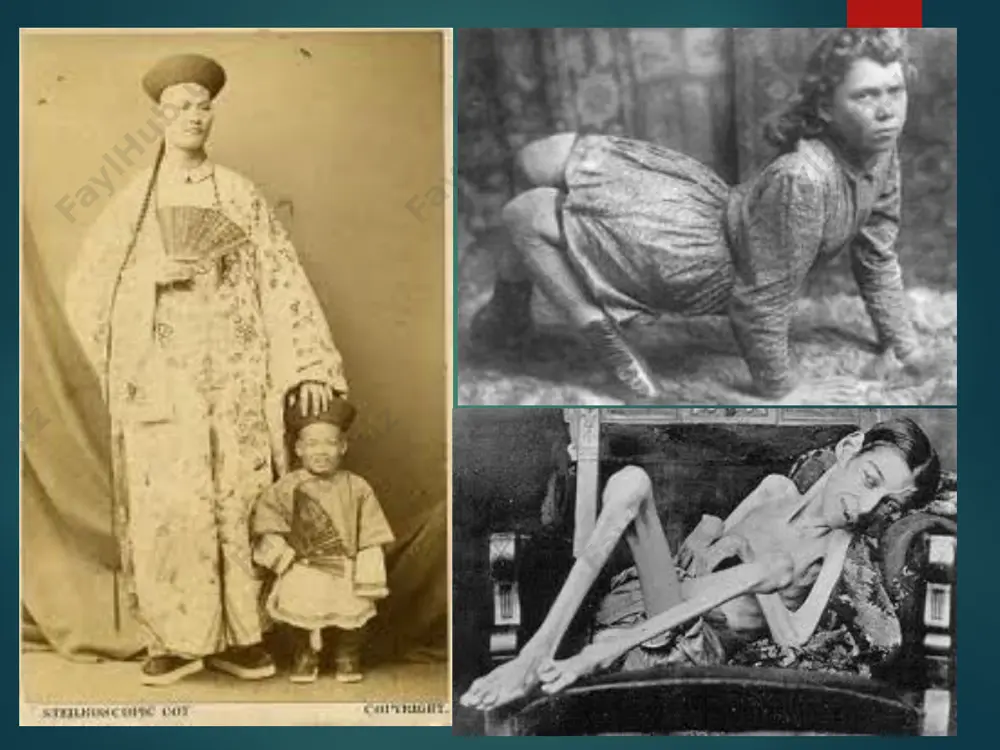 bosh suyagi va bosh miyaning tug’ma nuqsonlari - Page 4