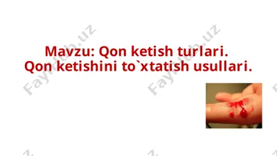 qonketishturlari va qonketishini to'xtatish usullari — PPTX