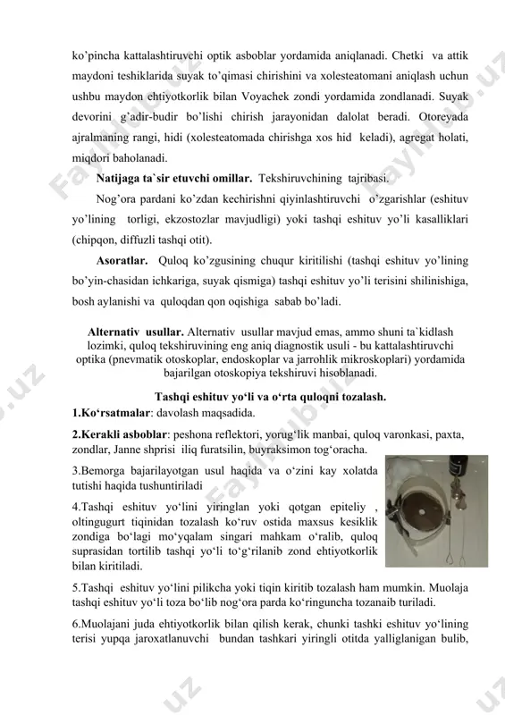 aholanadi. natijaga ta`sir etuvchi omillar. tekshiruvchining tajribasi. nog’ora pardani ko’zdan kechirishni qiyinlashtiruvchi o’zgarishlar (eshituv yo’lining torligi, ekzostozlar mavjudligi) yoki tashqi eshituv yo’li kasalliklari (chipqon, diffuzli tashqi otit). asoratlar. quloq ko’zgusining chuqur kiritilishi (tashqi eshituv yo’lining bo’yin-chasidan ichkariga, suyak qismiga) tashqi eshituv yo’li terisini shilinishiga, bosh aylanishi va quloqdan qon oqishiga sabab bo’ladi. alternativ usullar. alternativ usullar mavjud emas, ammo shuni ta`kidlash lozimki, quloq tekshiruvining eng aniq diagnostik usuli - bu kattalashtiruvchi optika (pnevmatik otoskoplar, endoskoplar va jarrohlik mikroskoplari) yordamida bajarilgan otoskopiya tekshiruvi hisoblanadi. tashqi eshituv yo‘li va o‘rta quloqni tozalash. 1.ko‘rsatmalar: davolash maqsadida. 2.kerakli asboblar: peshona reflektori, yorug‘lik manbai, quloq varonkasi, paxta, zondlar, janne shprisi iliq furatsilin, buyraksimon tog‘oracha. 3.bemorga bajarilayotgan usul haqida va o‘zini kay xolatda tutishi haqida tushuntiriladi 4.tashqi eshituv yo‘lini yiringlan yoki qotgan epiteliy , oltingugurt tiqinidan tozalash ko‘ruv ostida maxsus kesiklik zondiga bo‘lagi mo‘yqalam singari mahkam o‘ralib, quloq suprasidan tortilib tashqi yo‘li to‘g‘rilanib zond ehtiyotkorlik bilan …