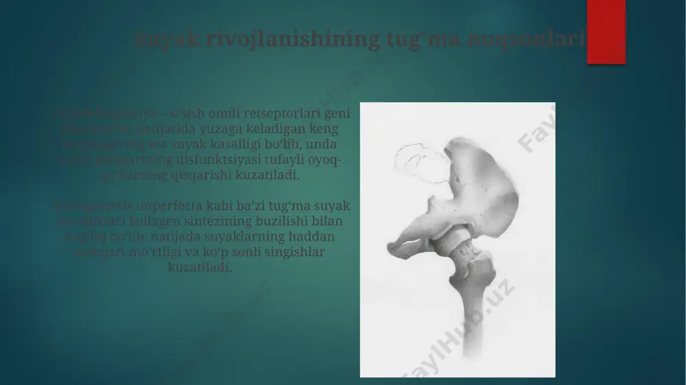 o'qolishi) yoki osteoblastik (yangi suyak to'qimasining hosil bo'lishi) bo'lishi mumkin, bu esa radiologik tasvirlarda 1 dan 5 gacha lyuis darajasiga qarab farqlanadi. osteonekroz klinikasi osteonekrozning dastlabki bosqichlarida mri tekshiruvi o‘zgarishlarni aniqlashda yuqori sezuvchanlikni (90% dan yuqori) namoyon qiladi, bu erta tashxis qo'yishga yordam beradi. osteonekrozning klinik ko‘rinishlari og‘riq bilan boshlanib, 50% hollarda asta-sekin rivojlanadi va harakat cheklanganligiga olib keladi. tashxis va davolashning zamonaviy usullari suyak o'smalari diagnostikasi mr tomografiyasi va pet-kt yordamida aniqlanadi, bu esa 1-3 mm gacha bo'lgan o'smalarni aniqlash imkonini beradi. jarrohlik va kemoterapiya davolashning asosiy usullaridan hisoblanadi. osteoporoz diagnostikasida dexa-skanogrammasi suyak mineral zichligini 1 g/sm² dan kamroq o'lchab, kasallikning og'irlik darajasini aniqlashda muhim ahamiyatga ega. davolashda bisfosfonatlar va denosumab kabi dorilar qo'llaniladi. fraktura turlari suyak sinishi turlari orasida transversal (to'g'ri), oblik (qiya), spiral (burmali) va komminutiv (ko'p qismli) sinishlar kabi 4 ta asosiy toifa mavjud. greenstick sinishi, bolalarda ko'proq uchraydi, suyakning to'liq sinishi emas, balki faqat bitta …