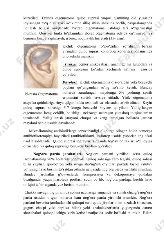va muvozanat a’zolarining tekshiruv natijalari asosida qo‘yiladi. davolash. birinchi tibbiy yordam quloqdan qon oqishini to‘xtatish, jarohat maydoniga birlamchi jarrohlik ishlov berish, uni zararsizlantiruvchi eritmalar bilan yuvish, teri ostiga qoqsholga qarshi anatoksinni yuborishdan iborat. tashqi eshituv yo‘lining torayishi yoki atreziyasini oldini olish maqsadida birinchi kundan boshlab eshituv yo‘liga levomikol yoki sintomitsin emulsiyasiga shimdirilgan pilikcha kiritiladi va boylam qo‘yiladi. har safar boylam almashtirilganda tashqi eshituv yo‘liga 10 tomchidan gidrokortizon suspenziyasi tomiziladi. yallig‘lanish jarayoni kamaygandan so‘ng tashqi eshituv yo‘liga silikondan yasalgan naychali kengaytirgich kiritiladi. bir vaqtning o‘zida bemorga antibiotiko-terapiya, fizioterapiya tadbirlari (tashqi eshituv yo‘li sohasiga tubus kvars, uvch, mikroto‘lqinli terapiya va lazerterapiya) buyuriladi. tashqi eshituv yo‘lining old-pastki devori singan hollarda pastki jag‘ suyagi boylam yordamida harakatsizlantirilib,bemorga vaqtincha faqat suyuq ovqat iste’mol qilish tavsiya etiladi. otgematoma - quloq suprasining tog‘ay va tog‘ay usti pardalari orasiga yoki teri ostiga qon quyulishi. otgematoma ayrim xollarda quloq sohasiga o‘tmas zarb tegishi yoki quloq suprasi uzoq vaqt davomida …