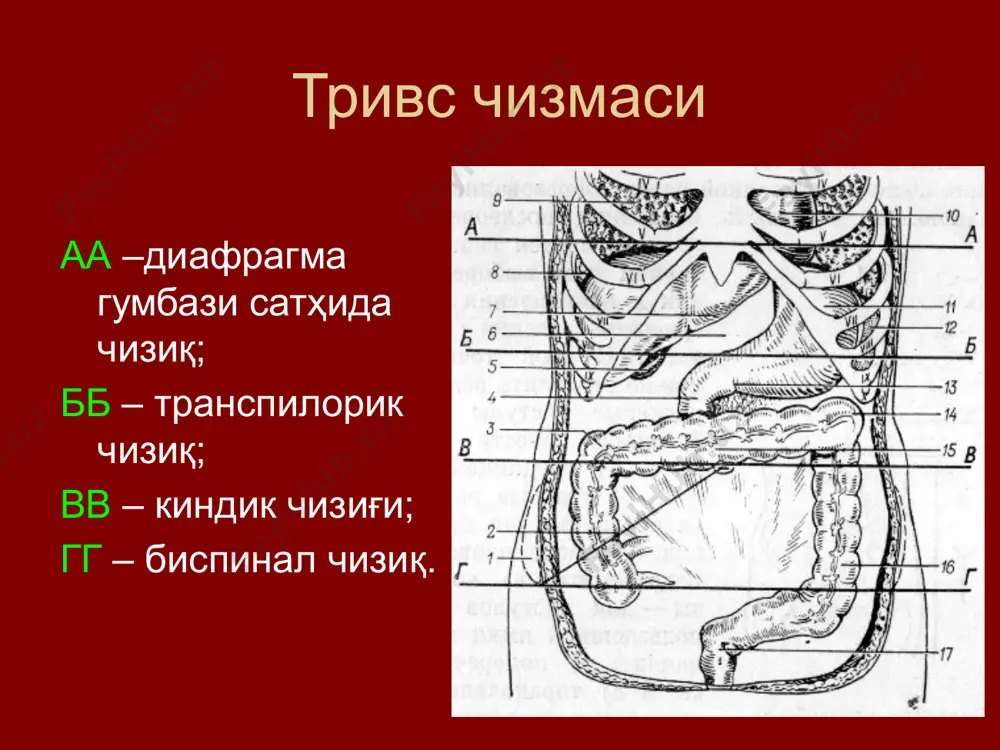 орин деворидаги нуқсонни (дарвозани) бартараф этиш – пластика: оддий – чок қўйиш (лексер, ру-краснобаев); реконструктив: 1) фасция-апоневротик (мартинов, мейо ва сапежко) 2) мускул-апоневротик (бобров, жирар, бассини) пластик чурра кесиш операцияси босқичлари: жирар-спассокукоцкий усули. узун чов канали бўлганда а.в.мартынов усули. болаларда ва бошланғич чурраларда тўғри чов чурраларида бассини усулини кукуджанов модификацияси билан амалга ошириш анча радикал ҳисобланади. сон чурралари пластикаси: бассини усули киндик чурралари пластикаси: сапежко, мейо ва лексер усуллари мейо усули сапежко усули катта чурраларда мускул билан пластика қилиш қўлланилади (р.и.венловский – қорин тўғри мускулининг лаҳтаги; постемский – соннинг кенг фасцияси лаҳтаги). чурра дарвозаларини ёпиш ва мустаҳкамлашнинг асосан учта гуруҳни ажратиш мумкин: 1) оддий; 2) реконструктив; 3) пластик. оддий усул: а) лексер – киндик чуррасида кисет чок; б) краснобаев, ру п–симон болаларда; ру-краснобаев усули: в) сон чурраси – чов бойламини қов суяги суяк усти пардаси (купер бойлами)га тикиш. 2. реконструктив усуллар: а) фасциал–апоневротик: а.в. мартынов бўйича (чов чурралари); мейо ва …