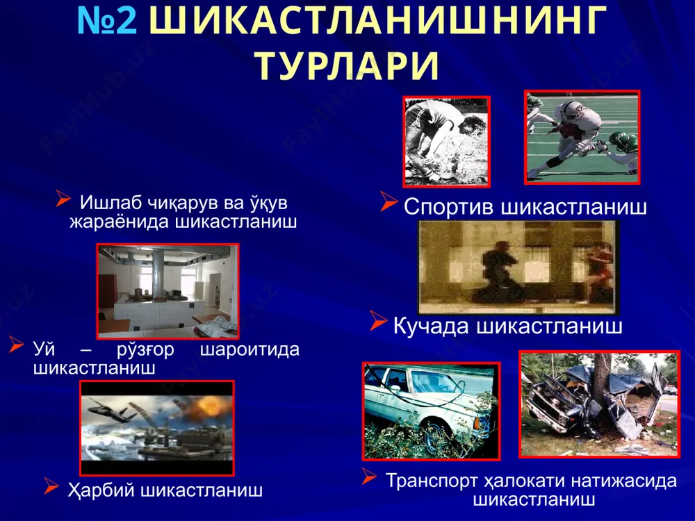 тўқима ажралмалари вужудга келади. чўзилиш – пай чўзилиши, буғим чиқиши каби шикастлар ҳосил қилади, бунда ҳаракатлантирувчи кучлар қарама – қарши томонга интилади. буралиш – суякларда спиралсимон (винтсимон) синишга сабаб бўлади, бунда ҳаракатлантирувчи куч тана қисмининг (қул – оёқ, бармоқ) уқи буйича айланма ҳаракатга интилади. №9 ўтмас восита таъсирида вужудга келган шикаст (шикастланиш) ҳусусиятига таъсир курсатувчи факторлар: зарба кучи (mv2/2), восита консистенцияси, ҳажми; зарба топографияси; зарбаловчи восита юзаси; таъсир бурчаги; таъсир йўналиши; организмнинг индивидуал ҳолати; кийим – кечак ҳусусияти, қалинлиги; соч қалинлиги, узунлиги ва бошқ. №10 механик шикастларда зарба кучини аниқлаш тери қопламаларига 130-160 дж куч таъсир қилганда қонталаш чақиради. 200 дж куч таъсирида терининг ёрилиши кўзатилади. 200 дж дан зиёд куч таъсирида эса, тери ости ёғ қатламининг эзилиши ва терининг кўчиши кўзатилади. узун найсимон суякларга 3000 н (300 кг) куч таъсир қилганда синиш кўзатилади. калла суякларига 4000 н (400 кг) куч таъсирида ёрилади. 8000 н (800 кг) куч билан таъсир …