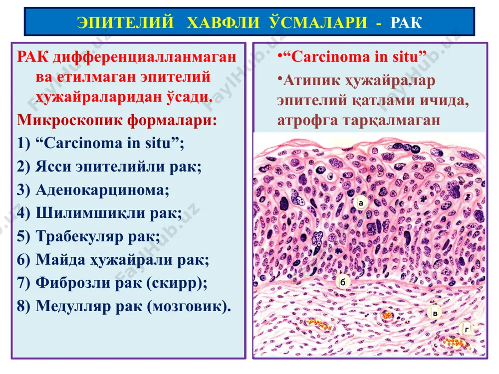ўсмалар. мезенхимал ўсмалар - Page 5
