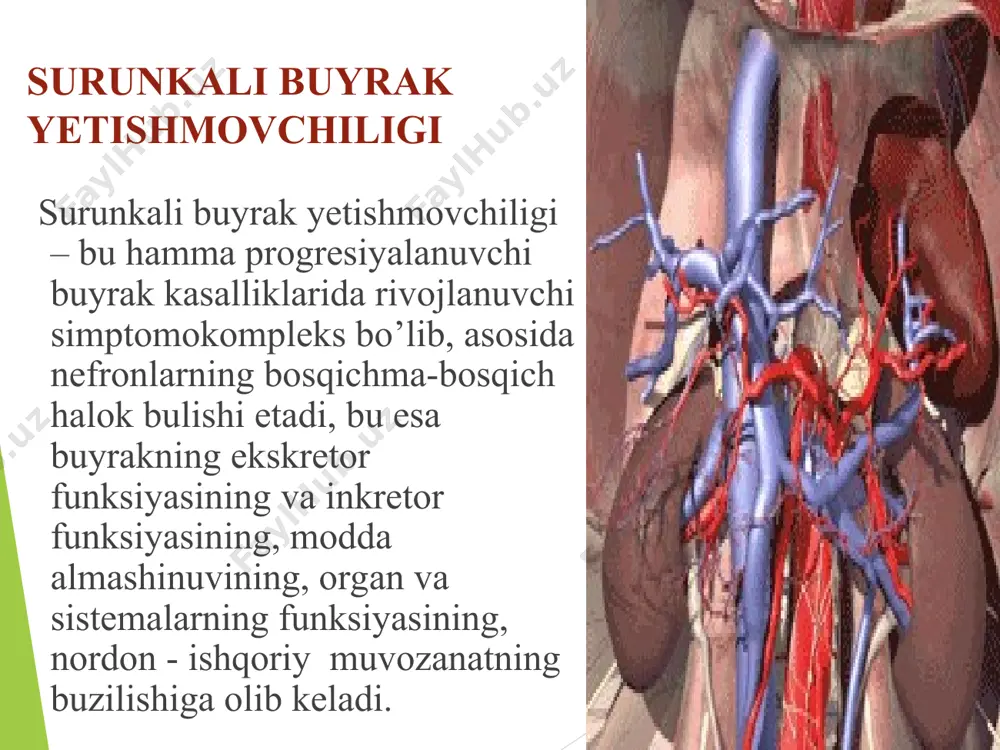 'p sababchilari bo'lib, glomerulonefrit, pielonefrit va boshqa sababli interstsial nefritlar hisoblanadi. sbye ning rivojlanishida qaysi etiologiyadan qatiy nazar morfologik o'zgarishlar bir hil bo'lib, glomeruloskleroz, interstsial fibroz, saqlangan nefronlarning gipertrofiyasi bilan kechadi. koptokchalar ichidagi gemodinamik o'zgarishlar gipertenziyada namoyon bo'lib, u koptokchalar arteriolalari tonusining pasayishi va rezervdagi buyraklar funksiyasining yo'qolishi tufayli ro'y beradi. patogenezi: sbye ning patogenezini 2 ta jarayon tashkil qiladi: 1. buyraklar parenhimasining sekinlik bilan sklerozga uchrashi va harakat qilayotgan nefronlar massasining kamayishi. 2. har bir nefrondagi koptokchalar filtrasiyasining kamayishi. bu o'z navbatida bazi bir biologik aktiv moddalarning to'planishiga, bazilarining esa etishmovchiligiga sabab bo'ladi. azot almashinuvining hosilalari, o'rta molekulyar og'irlikka (300-250 dalton) moddalar to'planib qoladi, juda kam miqdorda bo'ladi. patogenezi bu molekulyar moddalar tarkibi paratgarmon, natriy uretik omil va boshqa turli hil ingibitorlar (dnk, gemoglobin, fagositoz sintezlari) ham kiradi. ular bilan uremik intoksikasiya bog'liqligi o'rganilgan. organizmda toksik moddalar ko'paygan holatda bir hil moddalarning sintezi pasayadi, eritropoetinning sintezi pasayganligi sababli anemiya …