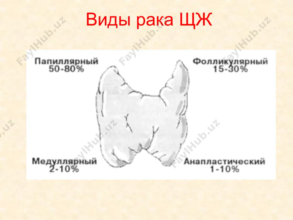 не прорастают в капсулу. на той стороне шеи, где расположен рак, могут быть метастазы. iii стадия. опухоль прорастает в капсулу щитовидной железы. она сдавливает трахею и окружающие ткани, спаивается с ними. появляются метастазы в шейные лимфатические узлы по обе стороны от железы. iv стадия. опухоль глубоко прорастает в окружающие ткани, щитовидная железа становится неподвижной и сильно увеличивается в размерах. обнаруживаются метастазы в ближних и отдаленных органах. операция при раке щитовидной железы показанием к проведению операции является подозрение на рак. если биопсия подтвердила, что в узле щитовидной железы есть раковые клетки, то его однозначно нужно удалять. если опухоль очень маленькая, то врач предложит удалить половину щитовидной железы с перешейком. эта операция называется гемитиреоидэктомия. оставшаяся доля берет на себя выработку гормонов. но большинство врачей считает, что лучшим вариантом будет полное удаление щитовидной железы - тиреоидэктомия. только в этом случае можно быть уверенным, что не пропущена никакая, даже самая маленькая, опухоль и рак …