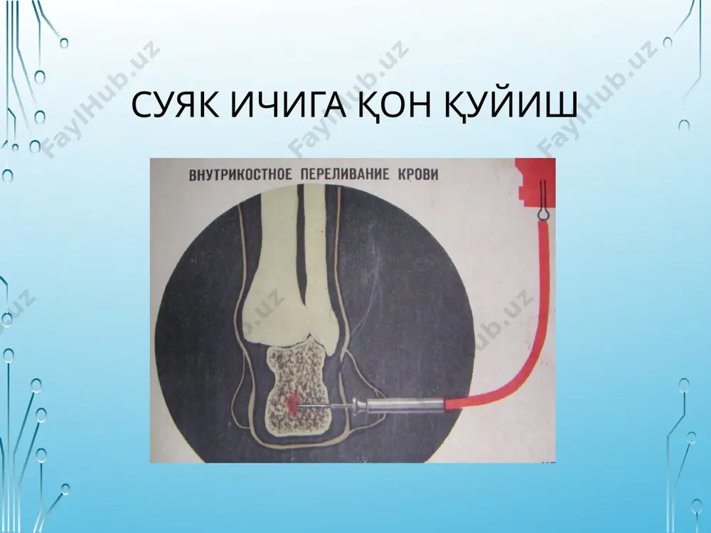 qon quyish turlari va usullari. sitratli zaharlanish - sabablari, tashxisi - Page 4