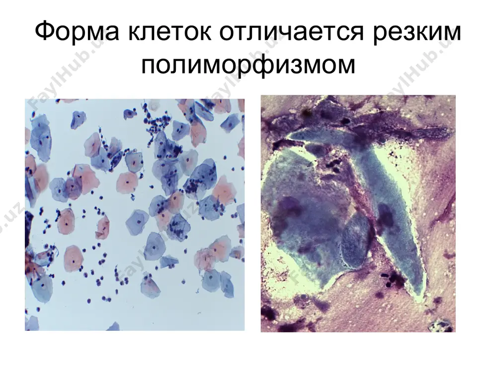 определение злокачественности клеточных элементов - Page 5