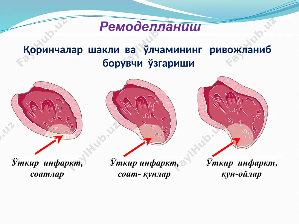 юрак ишемик касаллиги (сюе) - Page 5