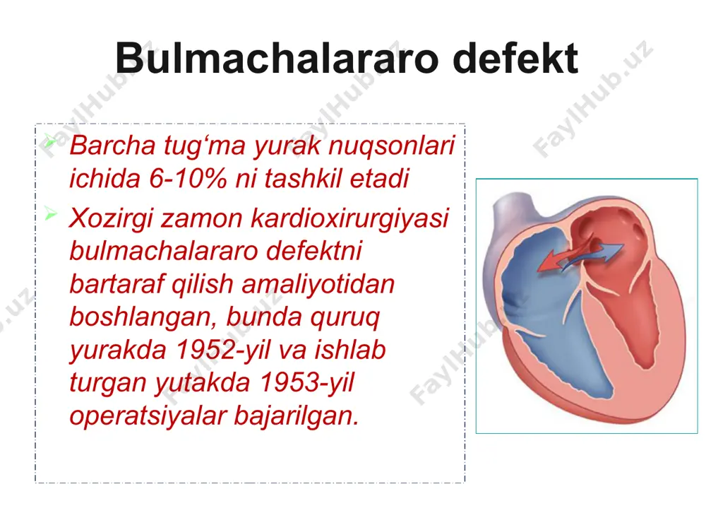 sh uchun transkateter sistemali (amplatzer) okklyuder fallo tetradasi o‘pka arteriyasini torayishi, korinchalar aro tusik nuksoni, aortani o‘ng tomonga siljishi va uni korinchalar aro to’siq nuqsonini ustida joylashishi o‘ng korincha devorining gipertrofiyasi fallo tetradasi fallo tetradasi umrovosti- upka anastomozi (blelok-tausig amaliyoti fallo tetradasida korinchalar aro to’siq nuqsoniga yamoq tikish aorta koarktatsiyasi bosh ogrishi arterial kon bosimining oshishi burindan kon ketishi yurak soxasidagi ogriklar yurak urishi boshda ogirlikni va pulsatsiyanni sezish aorta koarktatsiyasi