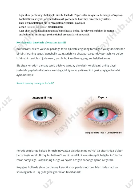 rsatadi. • shox pardaning tekislanishi va uning optik kuchining pasayishi uzoqni ko'ra olmaslik belgisidir • turli tekisliklarda shox parda shaklidagi anomaliyalar astigmatizmni ko'rsatadi • shox pardaning yupqalashishi keratokonus rivojlanishi bilan sodir bo'ladi • keratit - shox pardaning oldingi qatlamlarida infiltratlar sifatida namoyon bo'ladigan virusli infektsiya. shox parda kasalliklarini tashxislash va davolash shox parda kasalliklarini tashxislash uchun doktor belikovaning ko'z klinikasining oftalmologlari biomikroskopiya - yoriq chiroq yordamida ko'z tuzilmalarini kontaktsiz tekshirishni amalga oshiradilar. https://belikova.ru/services/lazernaya_korrektsiya_zreniya/blizorukost/ https://belikova.ru/services/lazernaya_korrektsiya_zreniya/blizorukost/ https://belikova.ru/services/lazernaya_korrektsiya_zreniya/dalnozorkost/ https://belikova.ru/services/lazernaya_korrektsiya_zreniya/dalnozorkost/ https://belikova.ru/services/lazernaya_korrektsiya_zreniya/astigmatizm/ https://belikova.ru/services/khirurgicheskoe_lechenie/krosslinking/ https://belikova.ru/services/konservativnoe_lechenie/keratity/ https://belikova.ru/services/diagnostika_zreniya/biomikroskopiya/ agar shox pardaning shakli yoki sinishi kuchida o'zgarishlar aniqlansa, bemorga ko'zoynak, kontakt linzalari yoki jarrohlik davolash yordamida ko'rishni tuzatish buyuriladi. ba'zi qiyin holatlarda biz kornea patologiyalarini davolash uchun keratoplastikadan foydalanamiz . agar shox parda kasalligining sababi infektsiya bo'lsa, davolovchi shifokor bemorga antibakterial, antifungal yoki antiviral preparatlarni buyuradi. ko'z keratiti: davolash, alomatlar, tasnifi ko'z keratiti sklera va shox pardaga ta'sir qiluvchi eng keng tarqalgan yallig'lanishlardan biridir. ko'zning yuzasi qanchalik tez qizarishi …