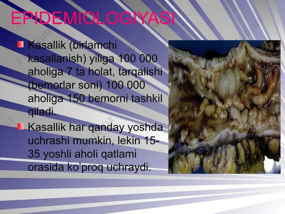 kron kasalligi - Page 3