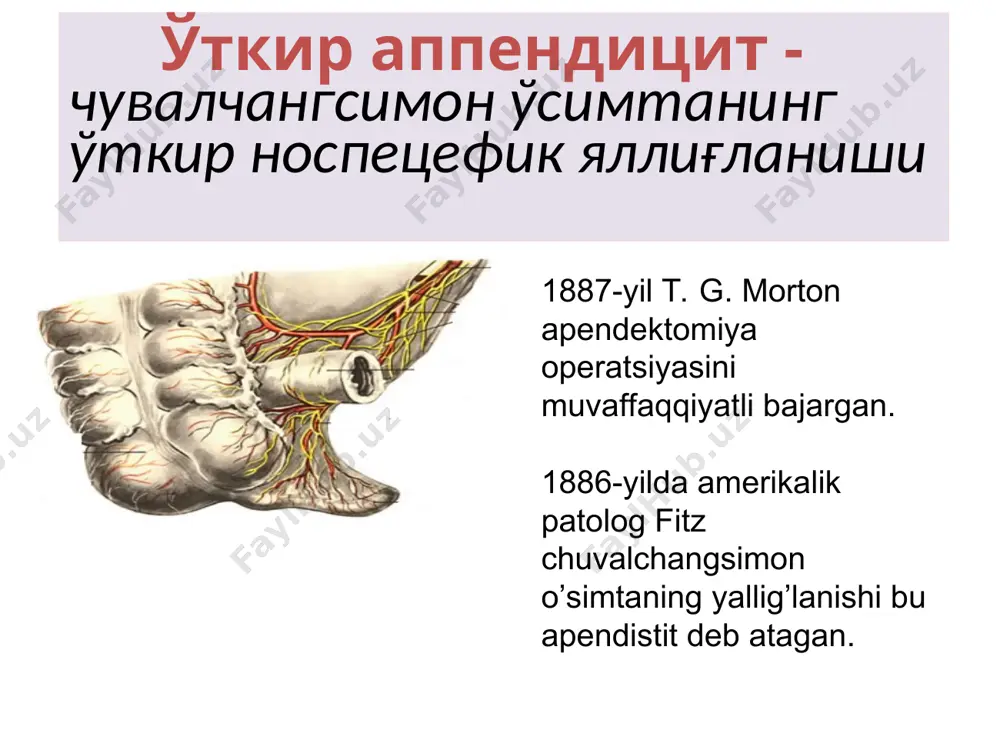 di) 1889-yil charlz mak-burney yozgan edi «meni fikrimcha, o’tkir appendistitda og’riqning eng sezilarli nuqtasi bir barmoq bilan bosilganda o’ng yonbosh suyagining oldingi-yuqori o’sig’i bilan kindik orasidagi chiziq orasidagi bir yarim, ikki dyuymni (3,8 va 5sm.) tashkil qiladi». 2. qusish o’tkir appendistitga reflektor bir yoki ikki marta qayt qilish xarakterli. faqat kichik yoshdagi (3 yoshgacha) bolalarda qayt qilish ko’p marotaba bo’lishi mumkin 3. ichak faoliyatining buzilishi bola yoshiga qarab turlicha bo’lishi mumkin. agar katta yoshdagi bolalarda qabziyat ko’p kuzatilsa, kichik yoshdagi bolalarda bir yoki ikki marotaba ich ketishi (diareya) kuzatilishi mumkin. qayt qilish va ichak funkstiyasining buzilishi ko’p jixatdan qorin parda yallig’lanishiga(kitiqlanishiga) bog’lik 3-yoshgacha bo`lgan bolalarda apenditsitning klinik ko`rinishi appenditsit xastaligi yangi tug`ilgan chaqaloqlarda to`satdan boshlanadi. ona bolaning bezovtalanishi, yig`lashi, ona kukragini olmaedi, tana haroratining 38-40c ga ko`tarilganligi, bir necha marta qusganligi, kam harakatligidan shikoyat qiladi. kasallik boshlanishida ichning suyuq kelishi kuzatiladi. bolada butun qorin devori bo’ylab o’g’riq, eksikoz, ko’p qusish …