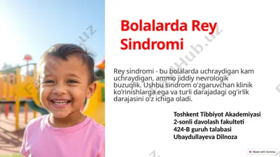 bolalarda rey sindromi — PPTX