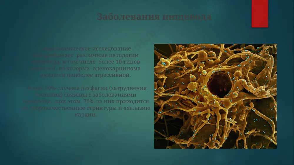 sistemi znachitelno variruetsya v zavisimosti ot stadii diagnostiki, sostavlyaya bolee 90% pri ranney diagnostike, no snijayas do 5% na pozdnix stadiyax. geneticheskaya predraspolojennost, kurenie, nepravilnoe pitanie i nizkaya fizicheskaya aktivnost uvelichivayut risk razvitiya bolee chem 70% sluchaev raka pishevaritelnoy sistemi. nespetsificheskiy yazvenniy kolit lechenie nyak vklyuchaet v sebya 5-aminosalitsilati, kortikosteroidi, immunomodulyatori i, v tyajyolix sluchayax, xirurgicheskoe vmeshatelstvo, naprimer, kolektomiyu. pri nyak nablyudaetsya povishenniy risk razvitiya kolorektalnogo raka, dostigayushiy 18% posle 30 let techeniya zabolevaniya, chto trebuet regulyarnogo skrininga. zabolevaniya tonkoy kishki bolee 50 razlichnix vidov bakteriy mogut vizivat infektsionnie zabolevaniya tonkoy kishki, s simptomami, variruyushimi ot lyogkoy diarei do tyajyologo obezvojivaniya, trebuyushego gospitalizatsii. sindrom razdrajyonnogo kishechnika (srk), chasto proyavlyayushiysya v tonkom kishechnike, vstrechaetsya u 10-15% vzroslogo naseleniya i xarakterizuetsya xronicheskoy abdominalnoy bolyu, vzdutiem jivota i izmeneniyami stula. spasibo za vnimanie @taqdimot_robot image6.jpg image7.jpg image8.jpg image9.jpg image10.jpg image11.jpg image12.jpg image13.jpg image14.jpg image15.jpg image16.jpg image17.jpg image2.png image3.png image4.png image5.png