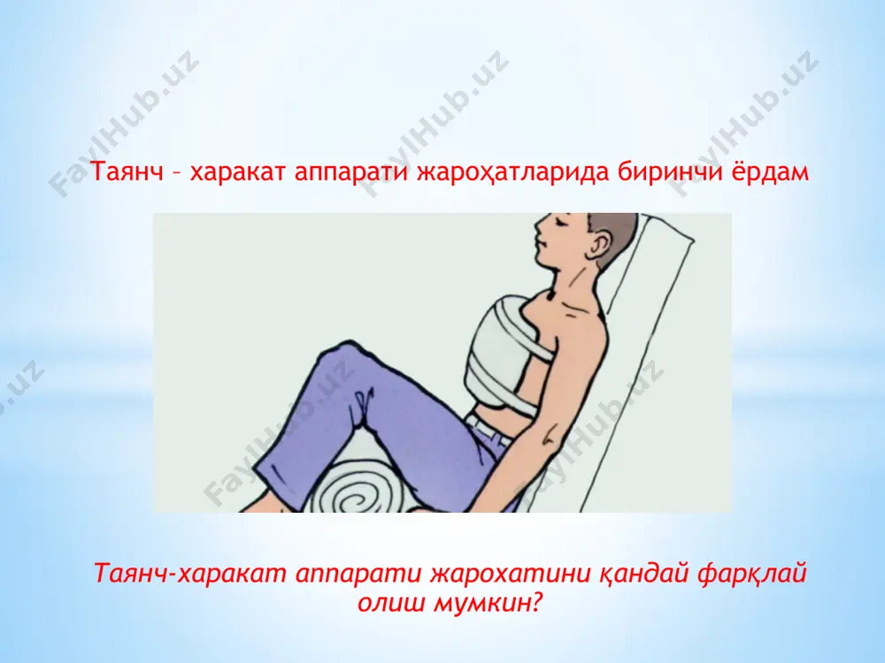 да, уларнинг ноодатий силжишлари намоён бўлади, бу синган суякларнинг катта қисмлари ностабиллиги билан тушунилади. 8. таянч-харакат аппаратининг жароҳатларидан энг кўп учрайдигани шикастлардан бири, буғимлар ва суяклар функциясининг бузилиши деб айтиш мумкин.бунда одам нафақат харакат, балким синган жойига боса олмайди. таянч- харакат аппарати жароҳатида биринчи ёрдам 1. таянч-харакат аппарати жароҳатида биринчи ёрдам кўрсатишнинг энг асосий компонентларидан бу жароҳатланаётган агентни кейинги таъсирини тухтатиш. масалан, оеқнинг болдир суяклари дарахт ёки столбанинг тушиши оқибатида синиши. оёқни зарарлаган дараҳт ёки столбани олиб ташламасдан, биринчи ёрдам кўрсата олмаймиз. 2. кейинги этапда жароҳатланган одамнинг жарохат жойини оғриқсизлантириш лозим, оқибатта шокка тушиш холатини олдини олган бўламиз. оғриқсизлантирувчи воситани имкон қадар мушак орасига ёки қон томири орқали амалга оширилиши лозим. агар имкони бўлмаса ошқозон-ичак тракти орқали киритилиши лозим. 3. жароҳатланган жойни оғриқсизлантиргандан сўнг махсус ёки қулбола шиналар орқали имкон қадар эртароқ ва сифатли боғлаб қўйиш керак. агар шина ва махсус боғламлар бўлмаса, румол ёки бинтлар билан боғлаб қуйиш мумкин. …