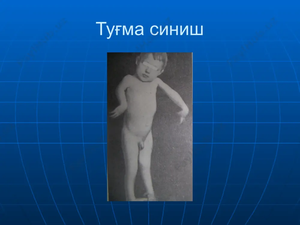 суякларнинг синиши ва чикиши - Page 5